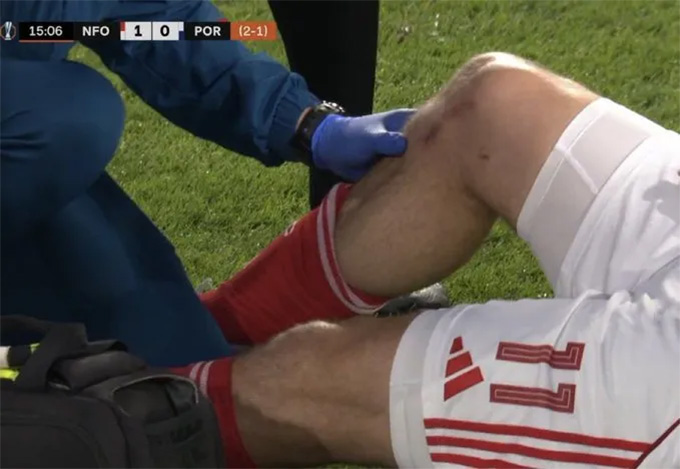 Tiền đạo Nottingham gục ngã: Chấn thương kinh hoàng khiến tất cả lặng người